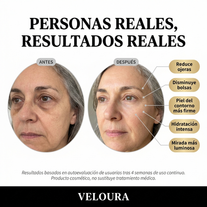 Crema de Ojos con Ácido Hialurónico